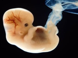 Embrio